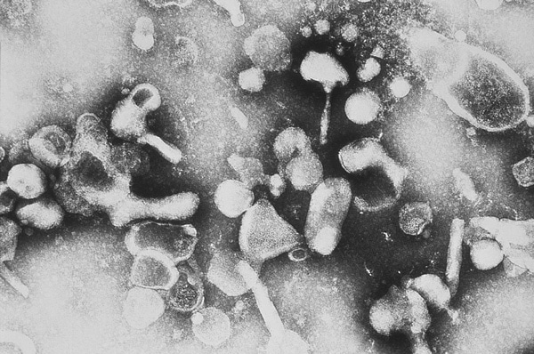Virus de la leucose féline au microscope électronique.